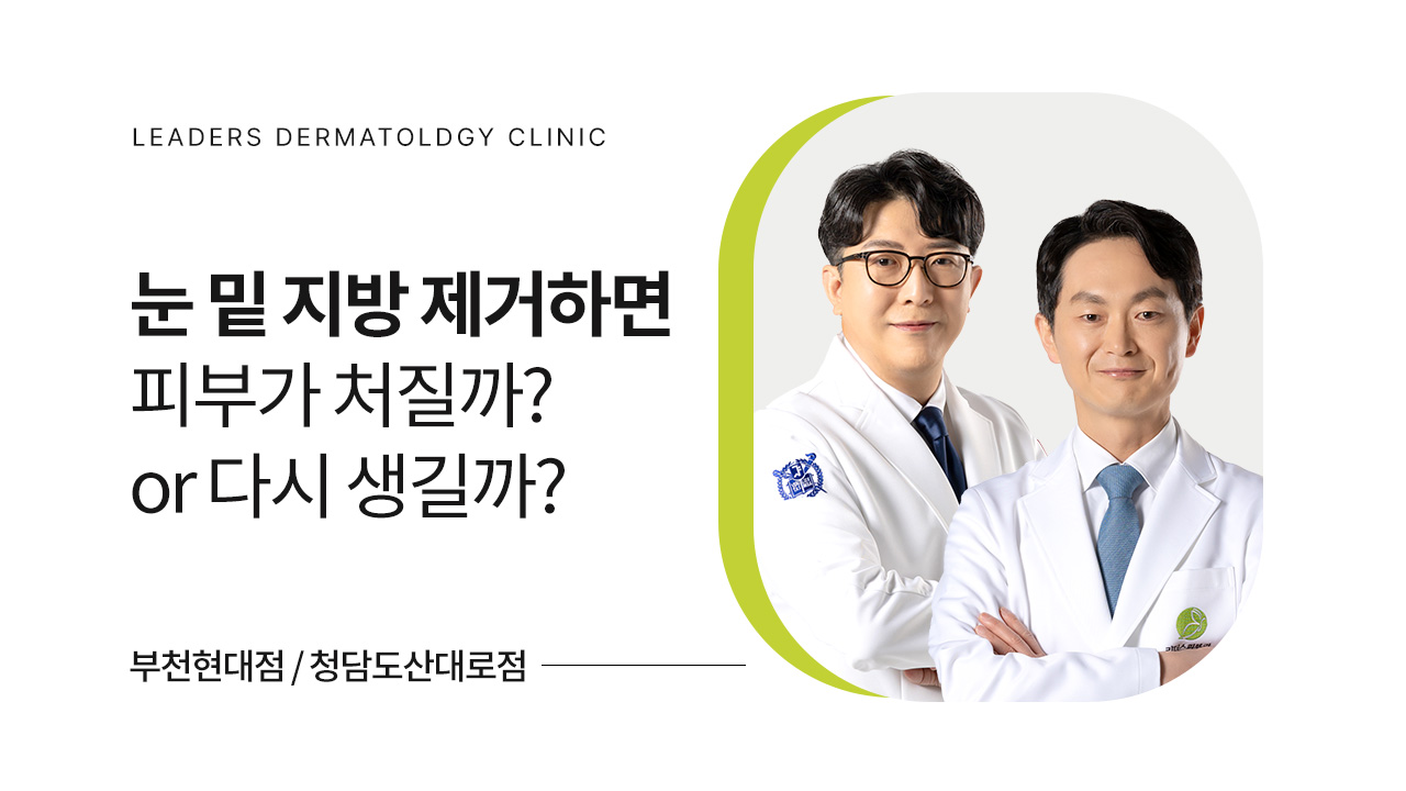 눈 밑 지방 제거하면